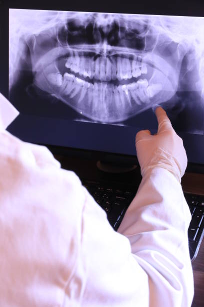 Best Emergency Tooth Extraction in Cross Plains, TX